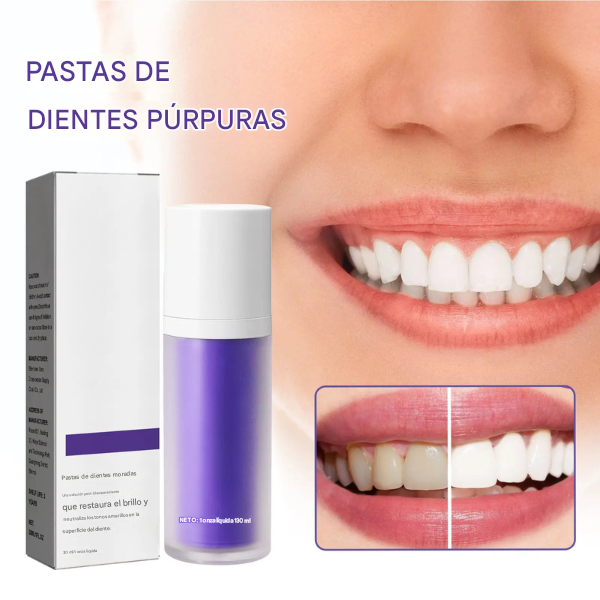 Blanqueador Dental Lila V34 para una sonrisa blanca y radiante