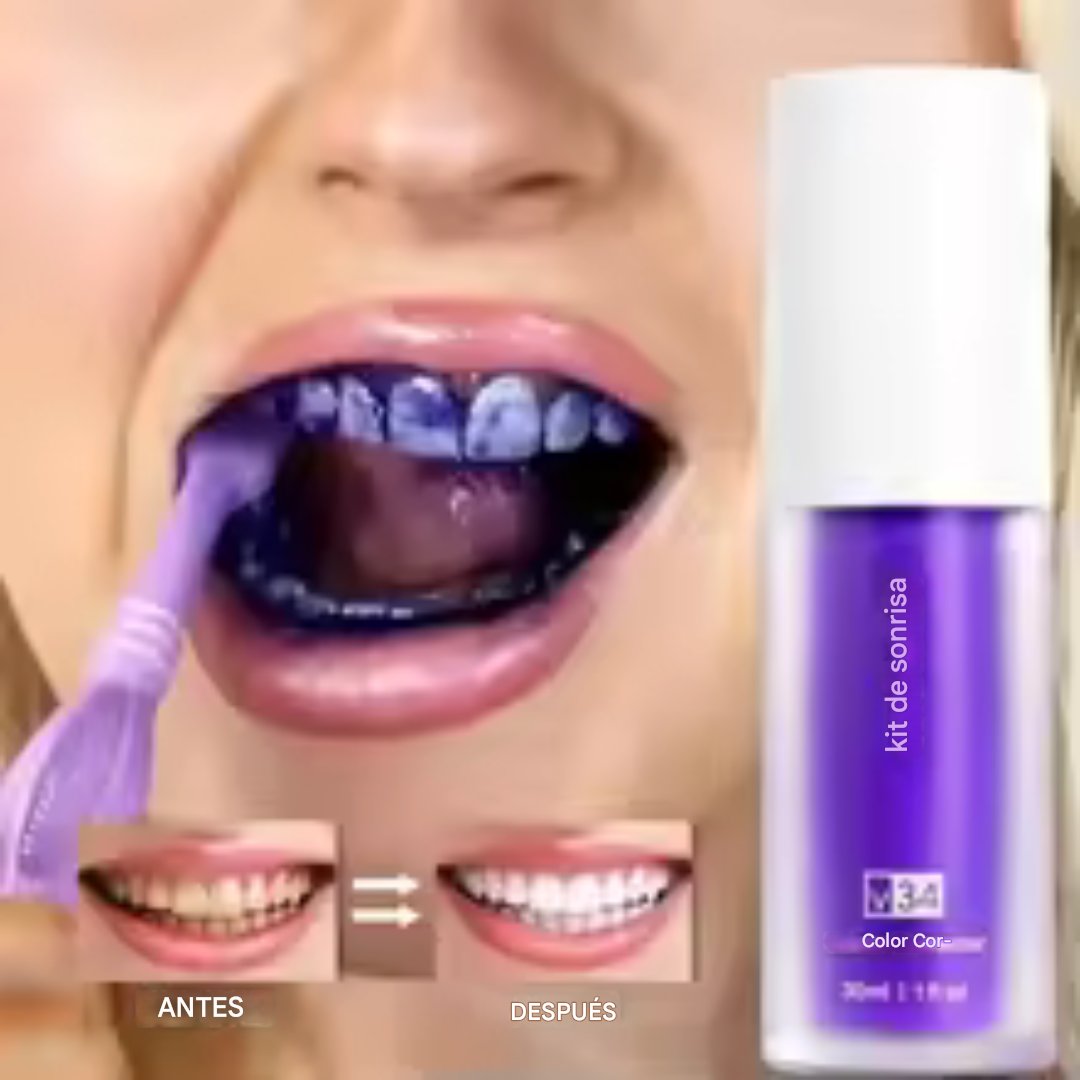 Blanqueador Dental Lila V34 para una sonrisa blanca y radiante