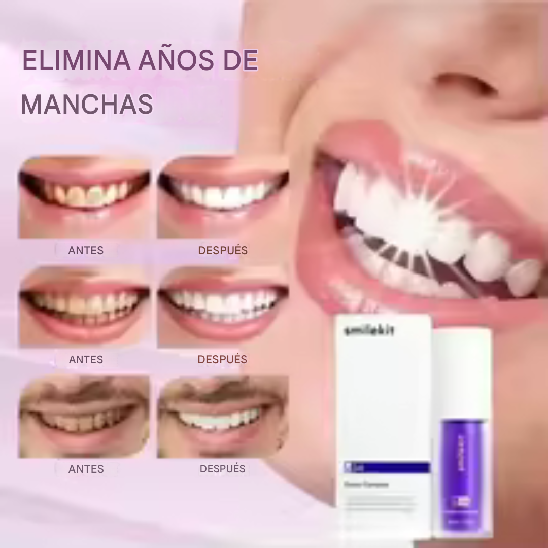 Blanqueador Dental Lila V34 para una sonrisa blanca y radiante