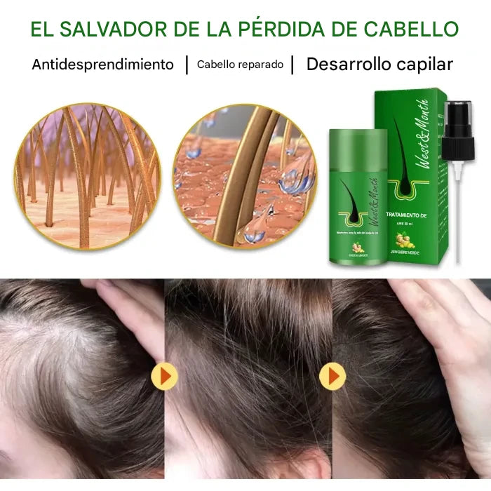 "Spray para el Crecimiento Capilar: Estimula el Crecimiento y Previene la Caída del Cabello"