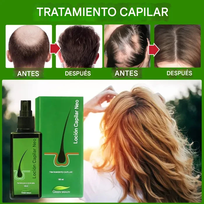 "Spray para el Crecimiento Capilar: Estimula el Crecimiento y Previene la Caída del Cabello"
