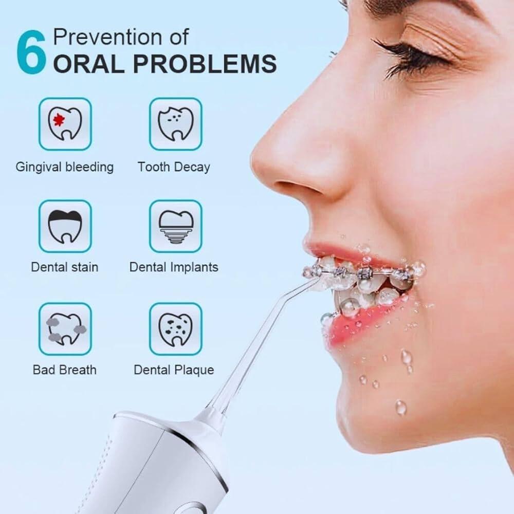 Irrigador Bucal PARA UNA SALUD DENTAL OPTIMA