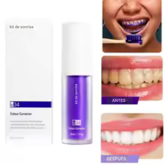 Blanqueador Dental Lila V34 para una sonrisa blanca y radiante